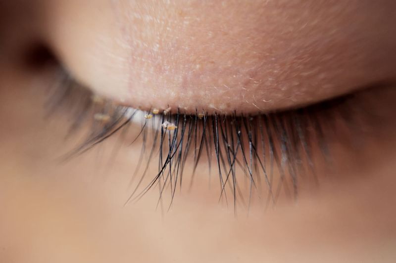 There Are Tiny Bugs Living in Your Eyelashes