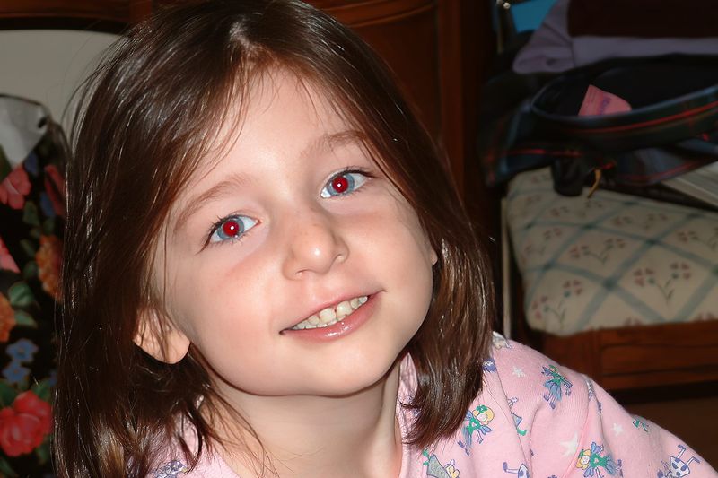 Red-Eye in Photos: The Demonic Portrait Problem