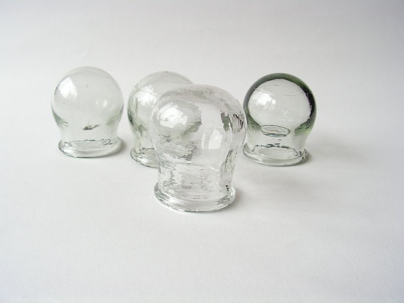 The Cellulite Suction Cups: Vacuum-Powered Smoothing